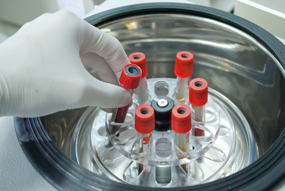 technician add blood tube in to centrifuge for separate serum out of red blood cells